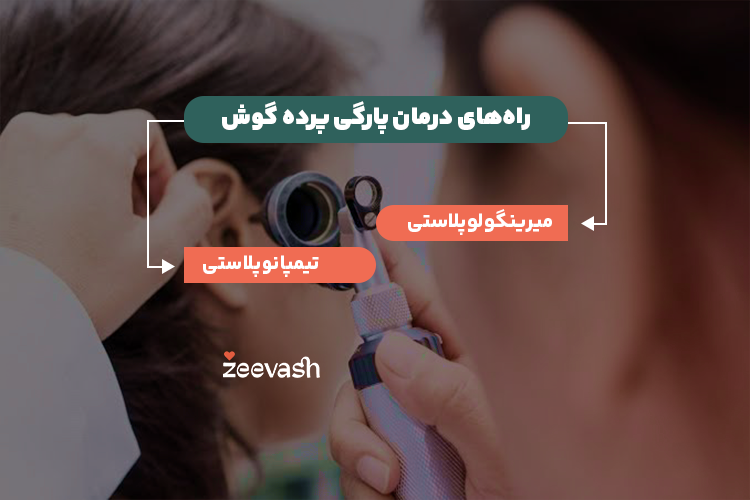 راه های درمان پارگی پرده گوش